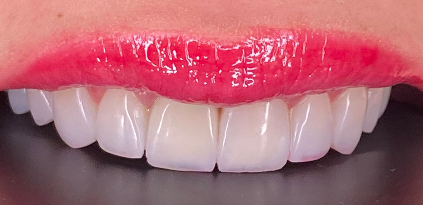 Imagem do WhatsApp de 2024-03-11 à(s) 19.21.01_b85bbcff.jpg